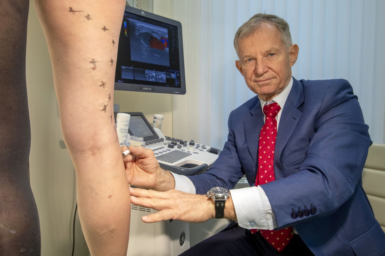 Křečové žíly nejsou jen estetický problém. Řešení může změnit i vás