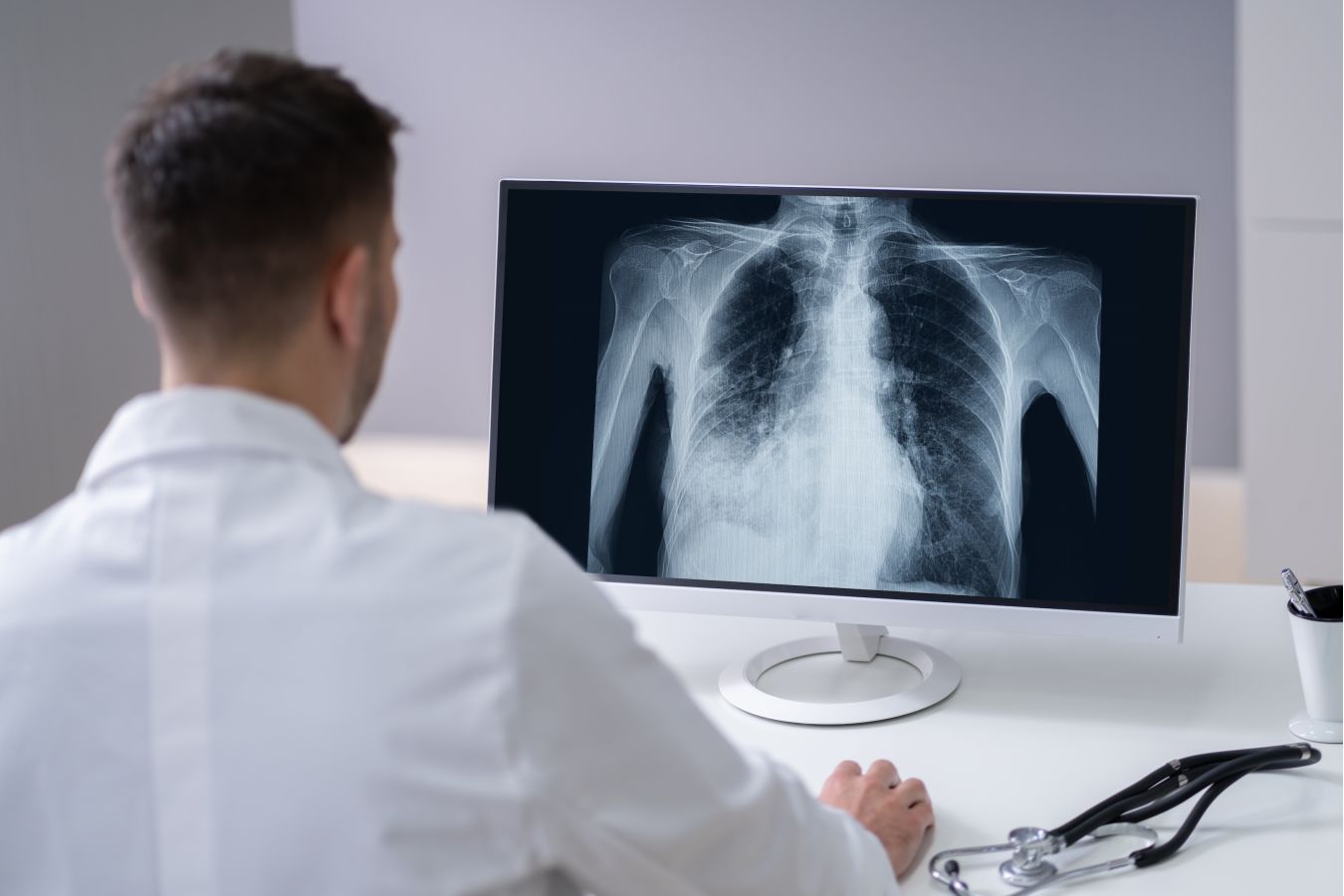 Pneumokok není dětská nemoc, nejvíce ohrožuje seniory a chronicky nemocné